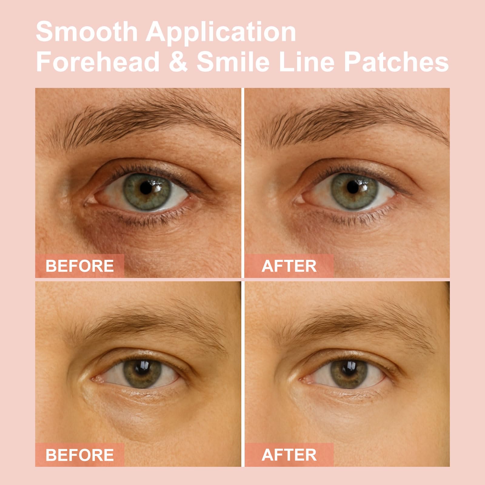 YLOTRE Novalift Micro Eye Patches smooth forehead and smile lines