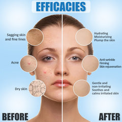 YMEYFAN jelly mask ingredients featuring hyaluronic acid and rose petals.