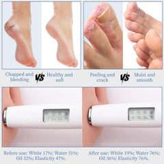 YOUNGYOUNGLOVE Urea Cream 70% with hyaluronic acid for lasting moisture.