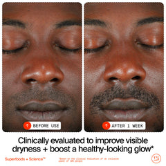 Youth To The People Adaptogen Cream with Dipeptide-1 supports sensitive skin comfort.