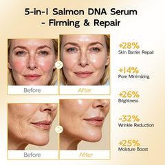 YouthVibe PDRN serum label highlights hyaluronic acid for plump, hydrated skin.
