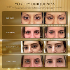 YOYORY 24K Gold Eye Patch reduces puffiness for a brighter look.