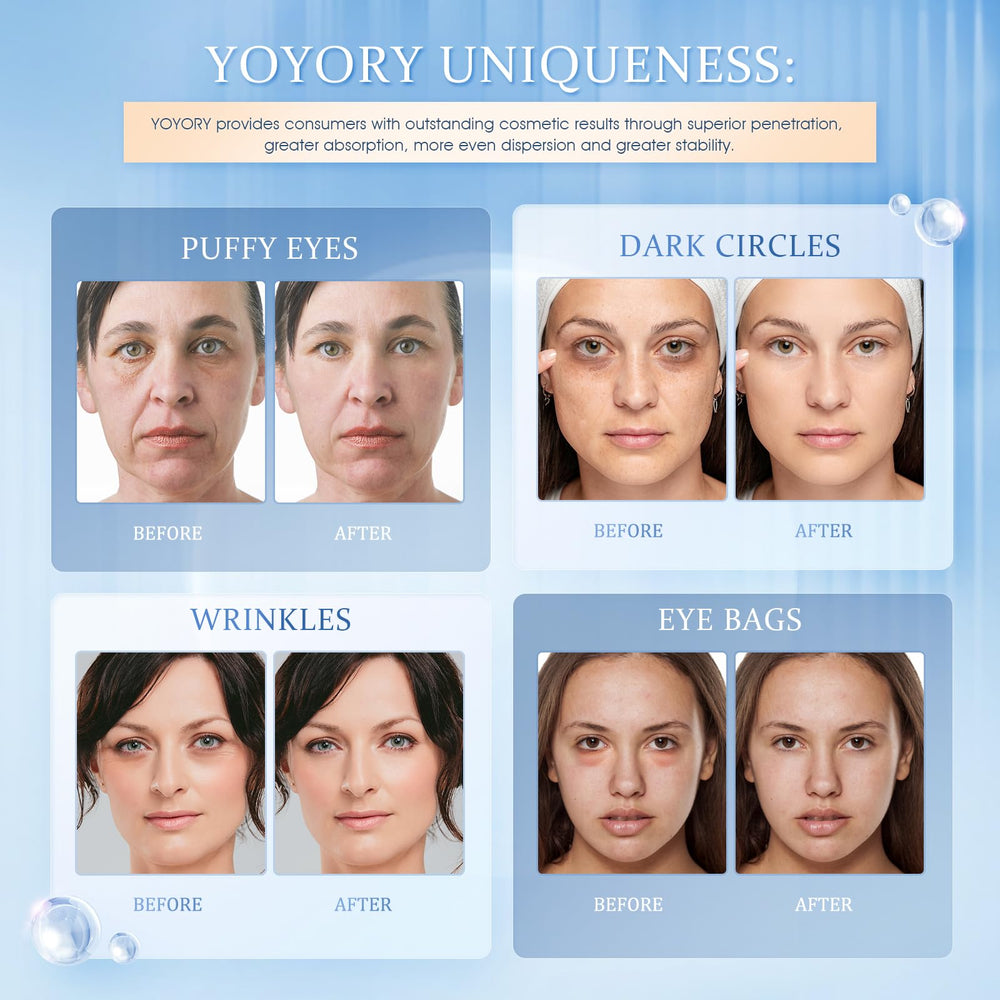 YOYORY after-use skin appears smoother and more hydrated under eyes