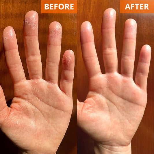 Yu-Be 40-percent glycerin formula highlighted for intense moisture.