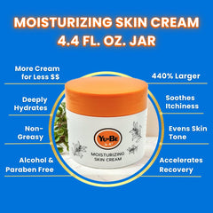 Yu-Be hands with dry skin before applying creamy moisture.