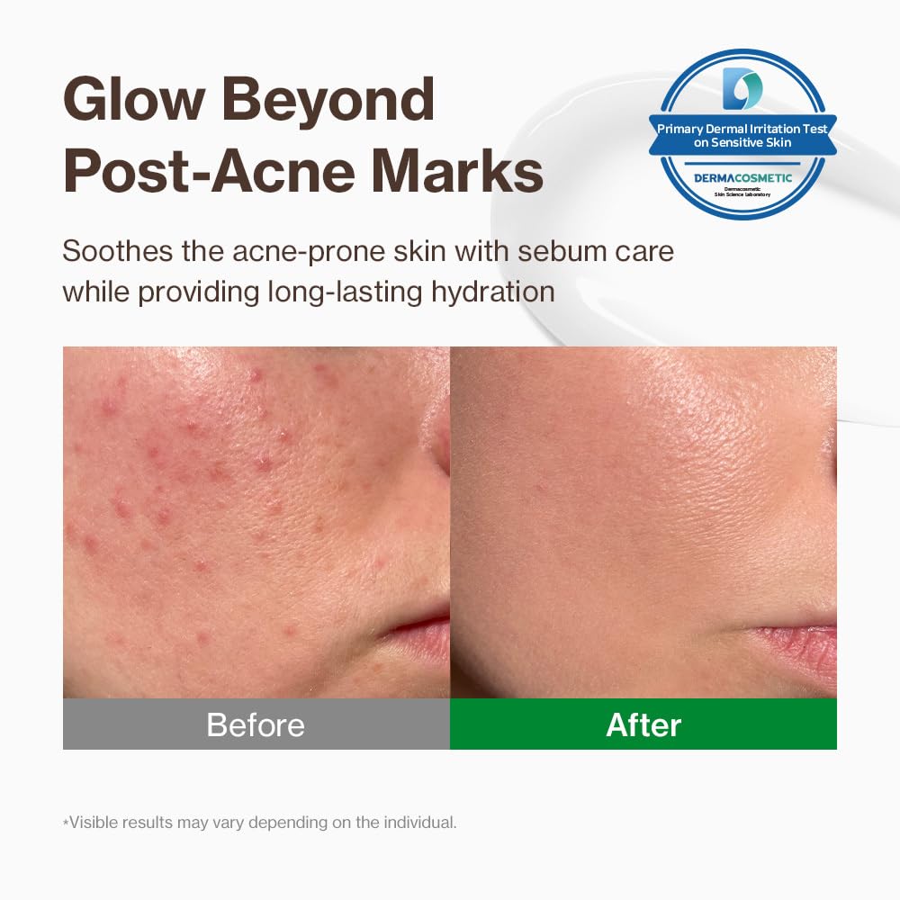 YUMU Cica Exosome Zinc Cream texture closeup shows lightweight gel-cream finish.