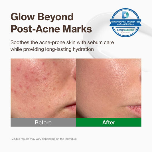 YUMU Cica Exosome Zinc Cream texture closeup shows lightweight gel-cream finish.