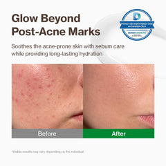 YUMU Cica Exosome Zinc Cream texture closeup shows lightweight gel-cream finish.