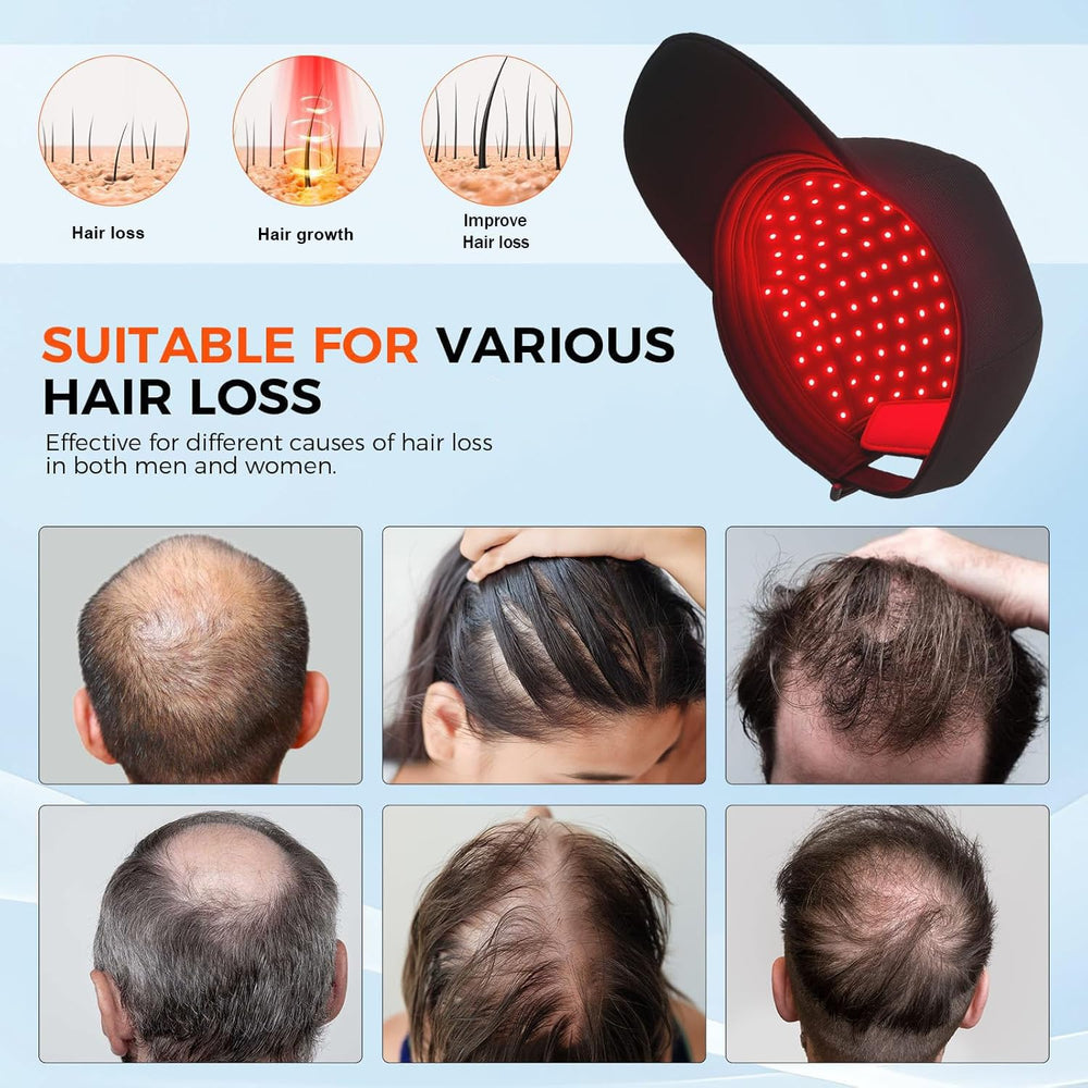 Yuxian Red Light Hair Growth Cap LED panel close-up with 660nm light