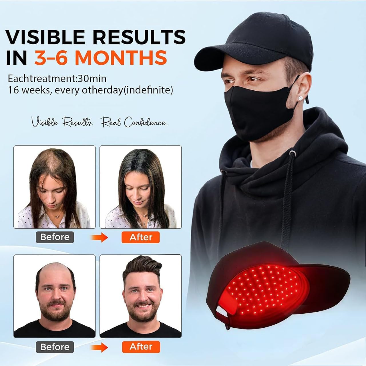 Yuxian Red Light Hair Growth Cap side view shows breathable fabric for long wear