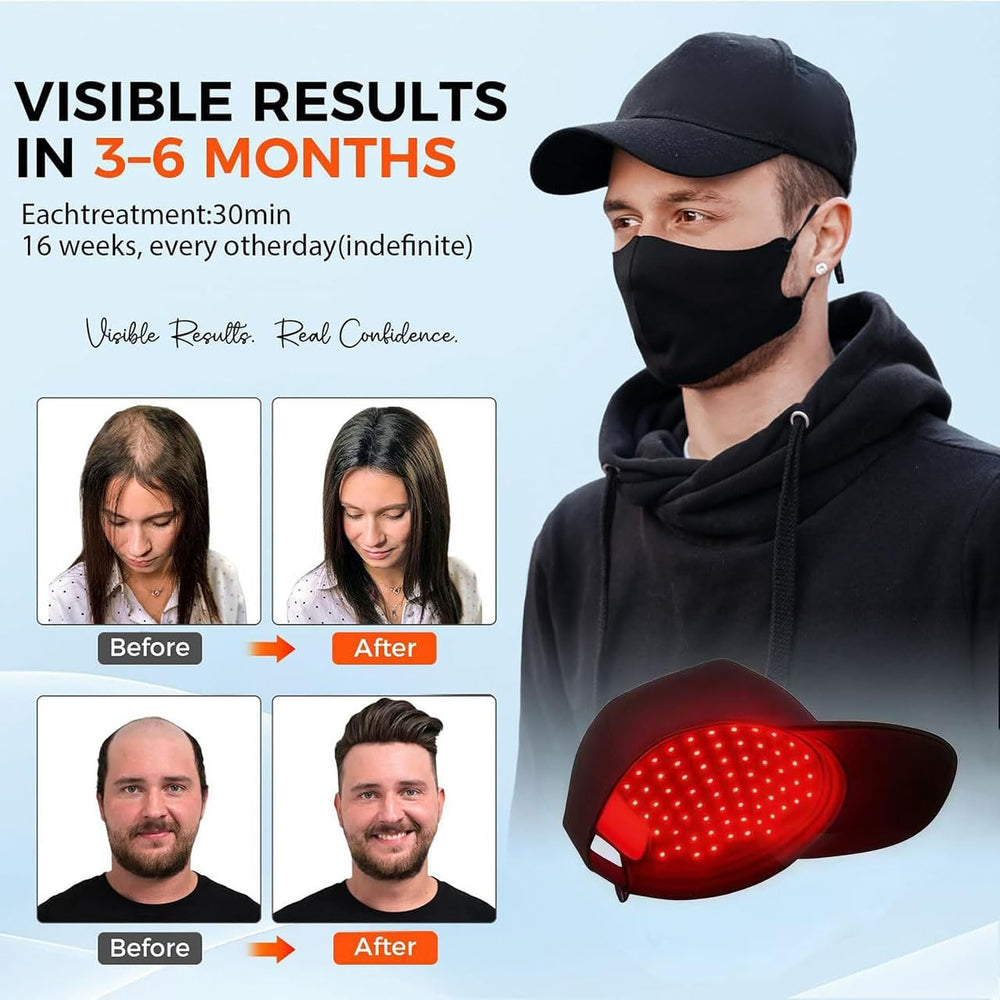 Yuxian Red Light Hair Growth Cap side view shows breathable fabric for long wear