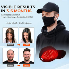 Yuxian Red Light Hair Growth Cap side view shows breathable fabric for long wear