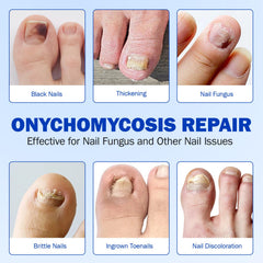 ZBQIEX Nail Repair Patches ultra-thin design feels invisible and comfortable.