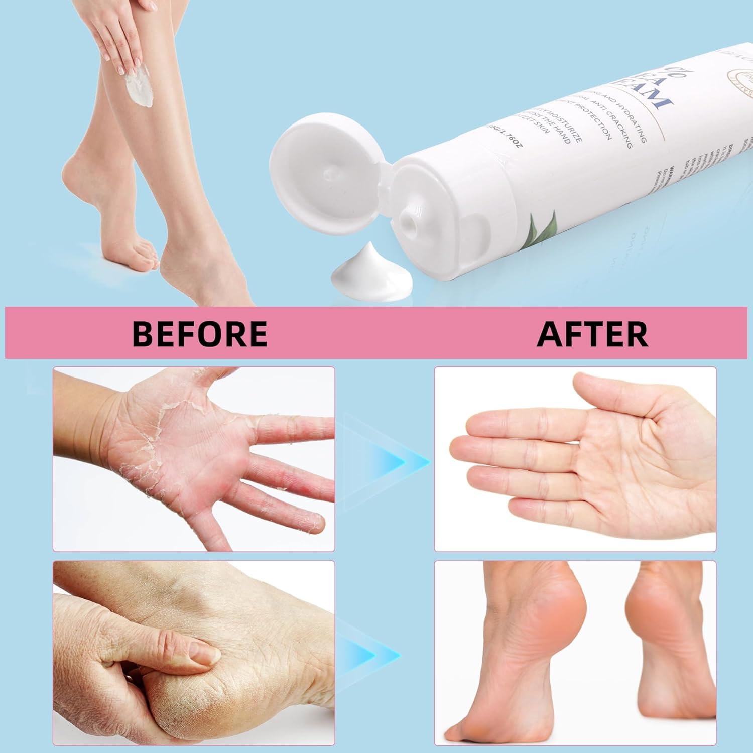 Natural ingredients like glycerin and avocado in Zegrox Urea Cream moisturize.