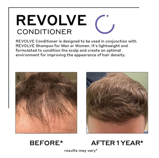 Zenagen Revolve conditioner swatch reveals lightweight, creamy texture for gentle scalp conditioning.