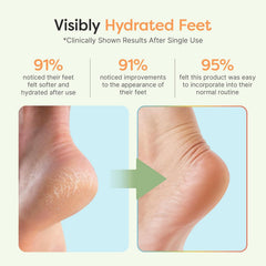 ZenToes open-toe design enables comfy sleep during treatment.