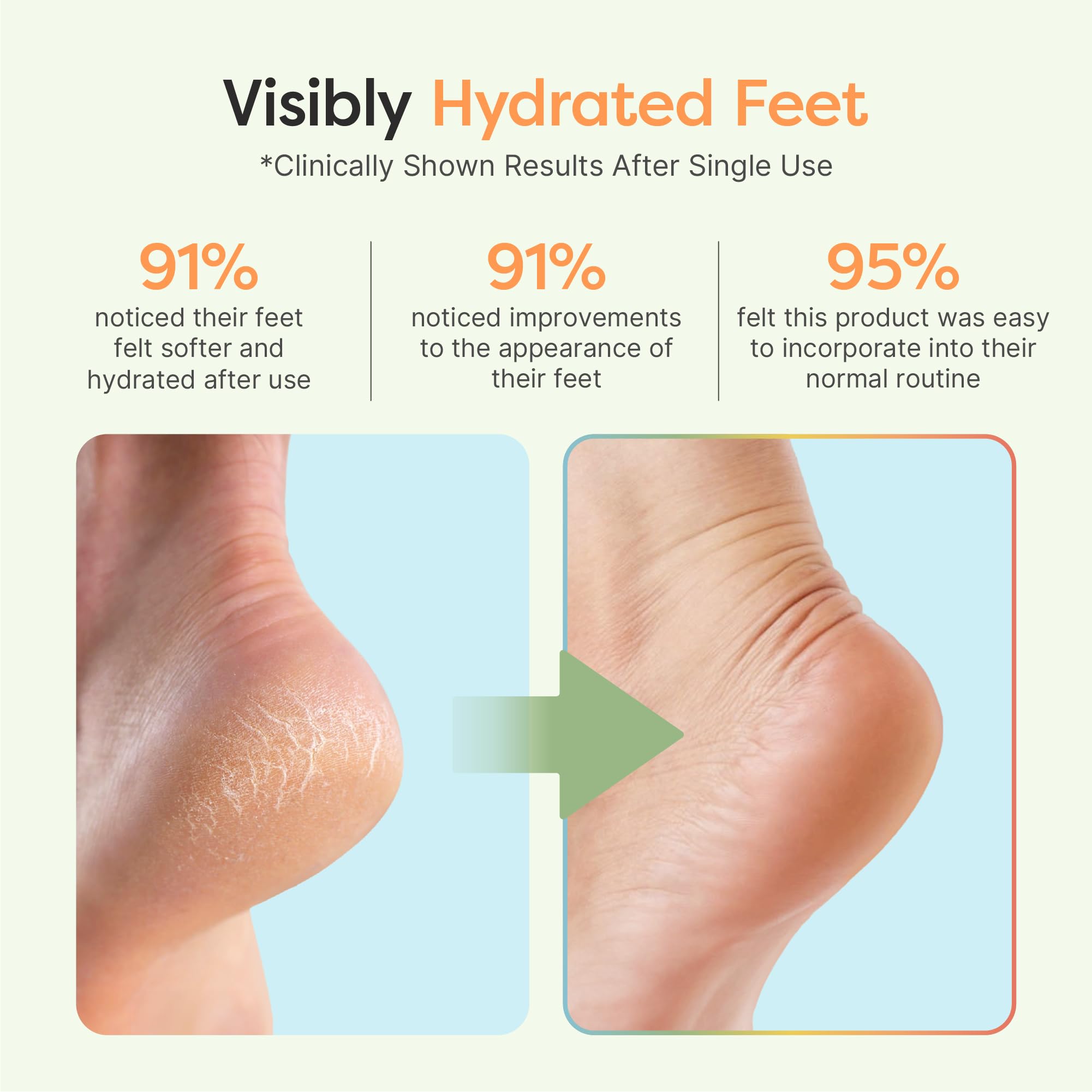 Open-toe ZenToes sock shown during sleep for comfortable hydration.