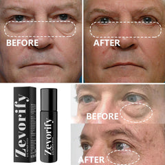 Zevorify Eye Repair Stick uses a lightweight formula suitable for sensitive skin.