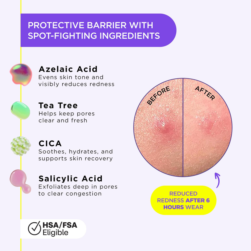 ZitSticka ingredients featuring tea tree, CICA, and salicylic acid.