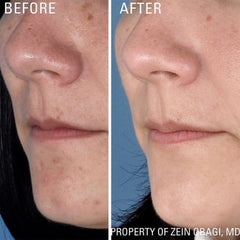 ZO Skin Health Instant Pore Refiner matte finish on skin surface.