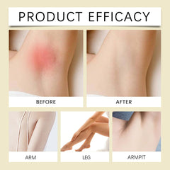 ZTSGU Cyperus Rotundus Oil shrinking-pores effect on skin appearance.