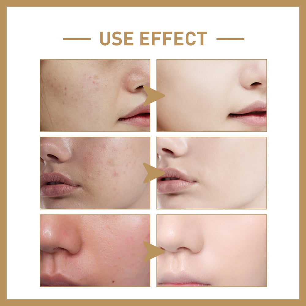 ZTSGU Relief rice extract highlights nourishing, balanced daily protection.