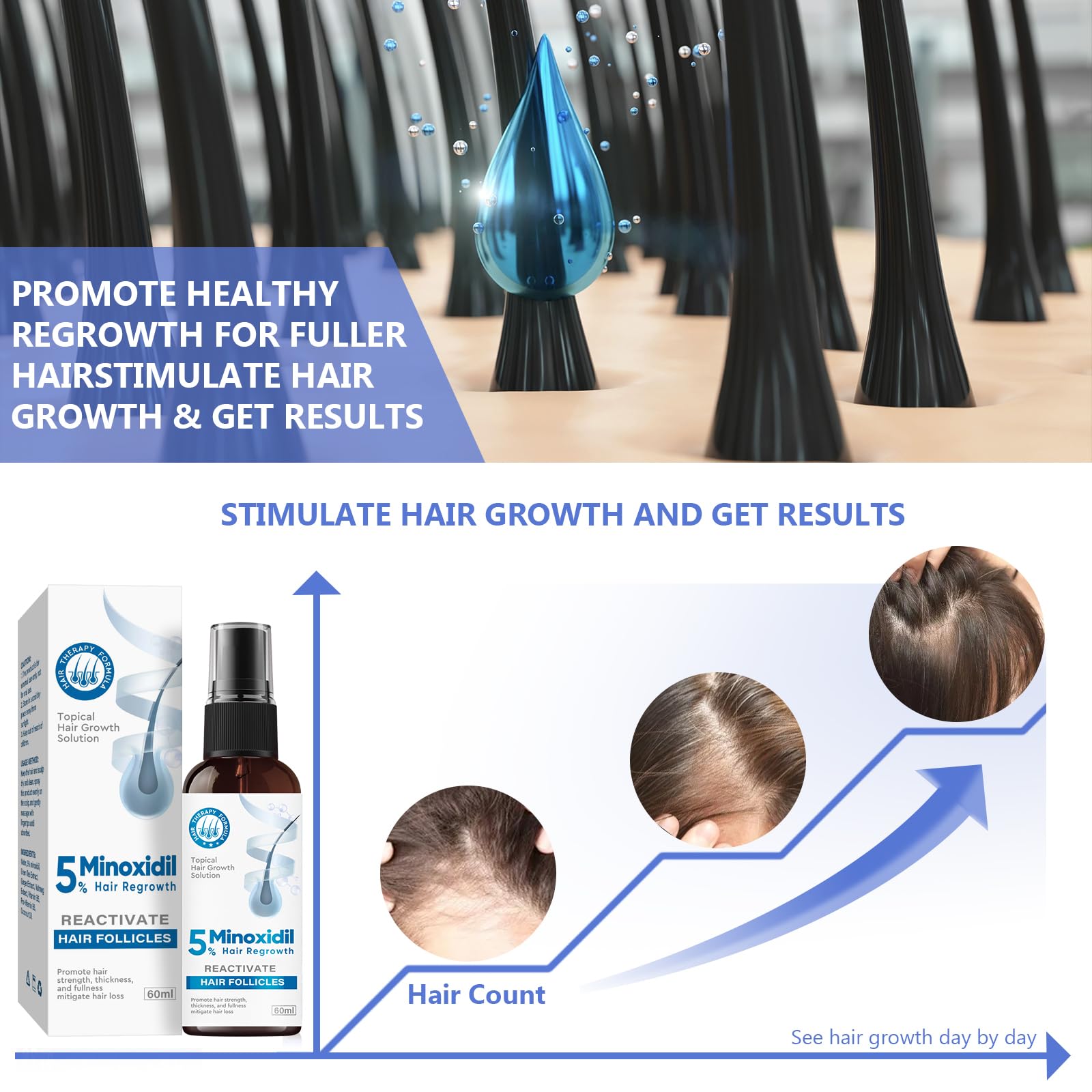 ZVBZVB Minoxidil fast-drying formula in practical use.