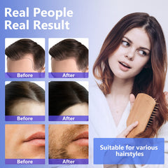 ZVBZVB Minoxidil spray on beard for fuller facial hair.
