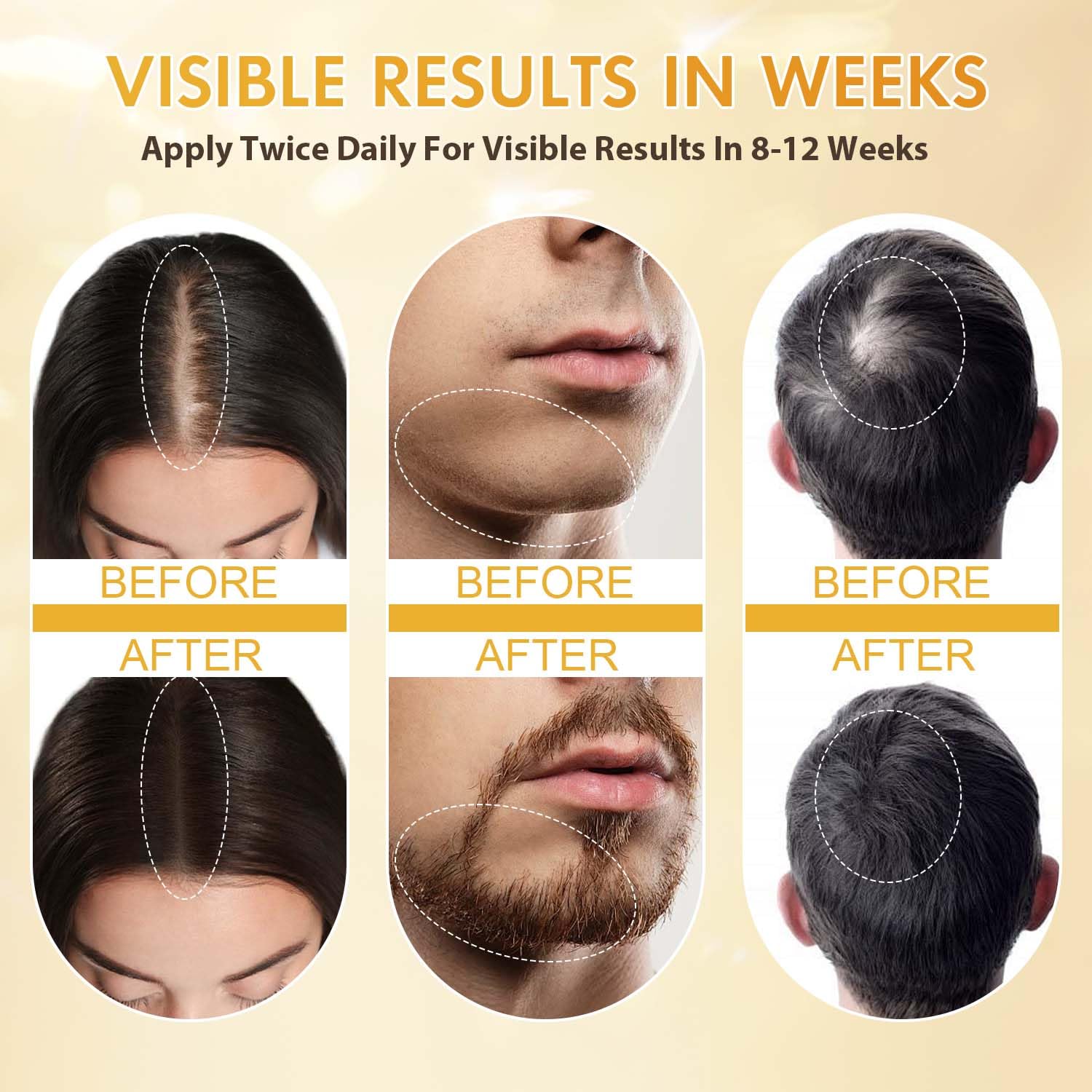 ZYXN Minoxidil packaging box shown for at-home hair care.