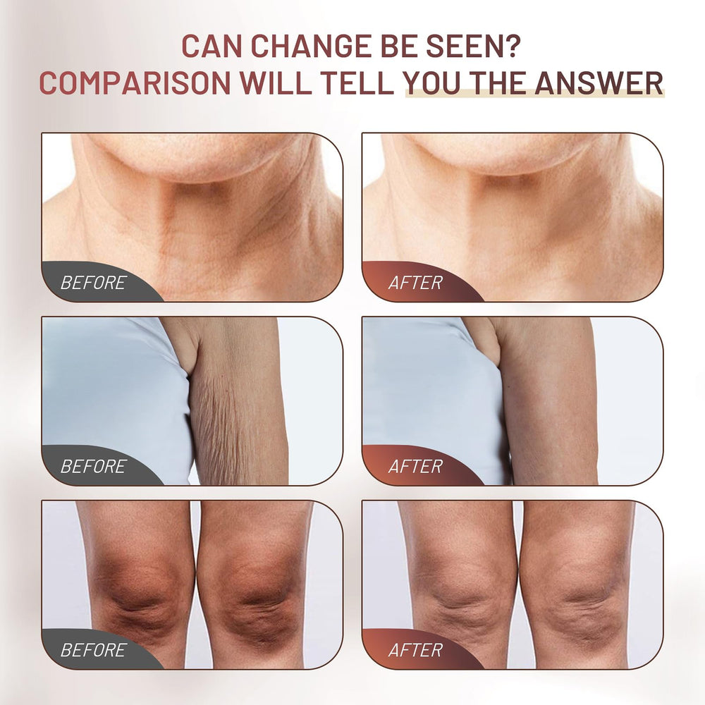 ZZILME Crepe Fix Cream hands with smoother, hydrated appearance.